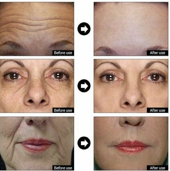 Hyaluronic Acid + Matrixyl 3000 Peptide Gel Cream Face & Eye Wrinkle Serum